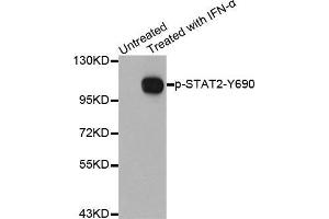 Western blot analysis of extracts from Hela cells using Phospho-STAT2-Y690 antibody. (STAT2 anticorps  (pTyr690))