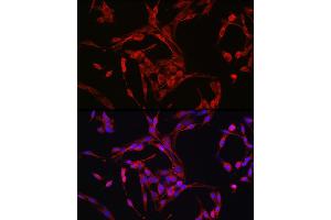 Immunofluorescence analysis of PC-12 cells using Cyclin B1 Rabbit pAb (ABIN3022806, ABIN3022807, ABIN3022808 and ABIN6219237) at dilution of 1:150 (40x lens).