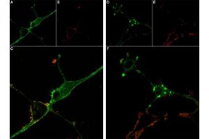 Live cell imaging of Stichodactyla Toxin-ATTO Fluor-590 in differentiated  cells. (Stichodactyla Toxin peptide (Atto 590))