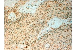 Immunohistochemistry: TET2 Antibody staining of Paraffin Embedded Human Spleen at 4 µg/ml. (TET2 anticorps  (Internal Region))
