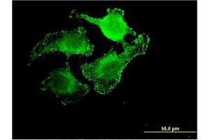 Immunofluorescence of monoclonal antibody to UNC5CL on HeLa cell. (UNC5CL anticorps  (AA 1-518))