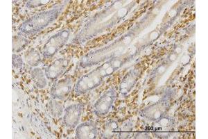 Image no. 4 for anti-Hematopoietic Cell-Specific Lyn Substrate 1 (HCLS1) (AA 266-356) antibody (ABIN598726) (HCLS1 anticorps  (AA 266-356))