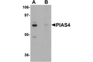 Western blot analysis of PIAS4 in rat brain tissue lysate with PIAS4 antibody at 1 μg/ml in (A) the absence and (B) the presence of blocking peptide. (PIAS4 anticorps  (N-Term))