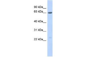 WB Suggested Anti-SSX7 Antibody Titration:  0. (SSX7 anticorps  (Middle Region))
