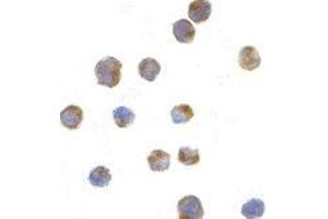 Immunocytochemistry of IRE1p in A20 cells with AP30445PU-N IRE1p antibody at 1 μg/ml.