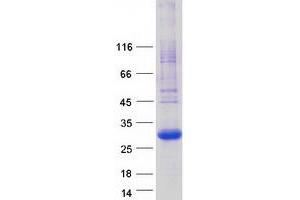 Validation with Western Blot