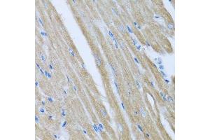 Immunohistochemistry of paraffin-embedded mouse heart using CCM2 antibody.
