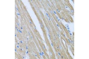 Immunohistochemistry of paraffin-embedded mouse heart using CCM2 antibody. (CCM2 anticorps  (AA 1-300))
