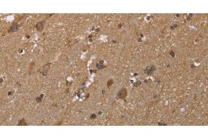 Immunohistochemistry of paraffin-embedded Human brain using GALK1 Polyclonal Antibody at dilution of 1:40