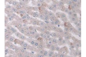 DAB staining on IHC-P; Samples: Rat Liver Tissue (COX-1 anticorps  (AA 23-277))