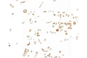 Immunocytochemistry (ICC) image for anti-Insulin-Like Growth Factor 1 Receptor (IGF1R) antibody (ABIN7795597) (IGF1R anticorps)