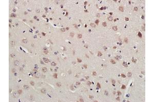 Paraformaldehyde-fixed, paraffin embedded Mouse brain; Antigen retrieval by boiling in sodium citrate buffer (pH6. (RNF213 anticorps  (AA 4750-4800))