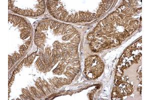 IHC-P Image H-Ras antibody detects H-Ras protein at membrane on mouse prostate by immunohistochemical analysis. (HRAS anticorps  (C-Term))