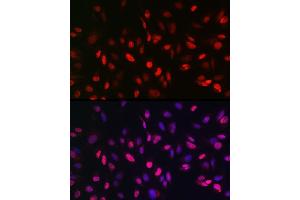 Immunofluorescence analysis of U2OS cells using KDM3A Rabbit pAb (ABIN6134725, ABIN6142790, ABIN6142791 and ABIN6215526) at dilution of 1:150 (40x lens).