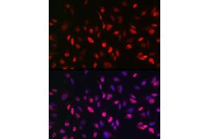 Immunofluorescence analysis of U2OS cells using KDM3A Rabbit pAb (ABIN6134725, ABIN6142790, ABIN6142791 and ABIN6215526) at dilution of 1:150 (40x lens). (KDM3A anticorps  (AA 350-450))