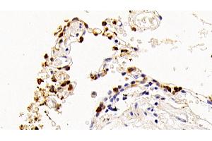 Detection of SPA2 in Human Lung Tissue using Polyclonal Antibody to Surfactant Associated Protein A2 (SPA2) (SFTPA2 anticorps  (AA 21-114))