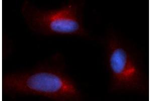 Immunofluorescence (IF) image for anti-Glutamine--Fructose-6-Phosphate Transaminase 1 (GFPT1) (AA 332-699) antibody (PE) (ABIN5568374)