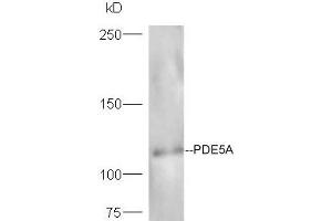Lane 1: mouse heart probed with Rabbit Anti-Axin1 Polyclonal Antibody, Unconjugated (ABIN740295) at 1:300 overnight at 4 °C. (Axin anticorps  (AA 761-862))