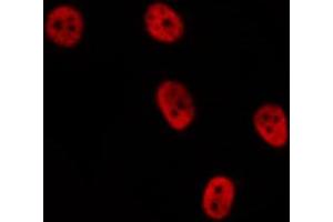 anti-Cyclin D2 (CCND2) (C-Term) antibody