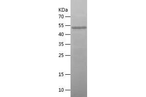 Western Blotting (WB) image for Zyxin (ZYX) (AA 2-168) protein (His-IF2DI Tag) (ABIN7125821)
