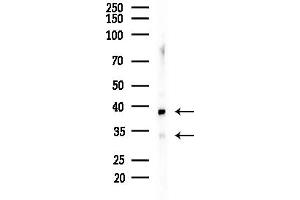 anti-Tumor-Associated Calcium Signal Transducer 2 (TACSTD2) (Internal Region) antibody