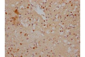 IHC image of ABIN7156707 diluted at 1:500 and staining in paraffin-embedded human brain tissue performed on a Leica BondTM system. (IFRD1 anticorps  (AA 1-200))