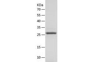 Triosephosphate Isomerase 1 (TPI1) (AA 1-249) protein (His tag)