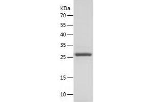 Western Blotting (WB) image for Triosephosphate Isomerase 1 (TPI1) (AA 1-249) protein (His tag) (ABIN7125495) (TPI1 Protein (AA 1-249) (His tag))