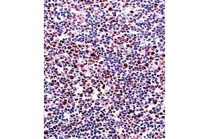 Immunohistochemistry (IHC) image for anti-Runt-Related Transcription Factor 2 (RUNX2) antibody (ABIN3003461) (RUNX2 anticorps)