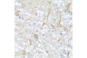 Immunohistochemistry of paraffin-embedded rat brain using SULT1A1 antibody at dilution of 1:100 (x40 lens). (SULT1A1 anticorps)