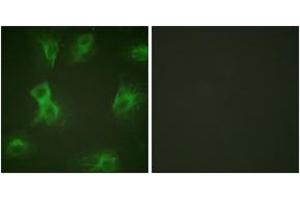 Immunofluorescence analysis of HeLa cells treated with Forskolin 40nM 15', using HRS (Phospho-Tyr334) Antibody. (HRS (HRS) (AA 301-350), (pTyr334) anticorps)