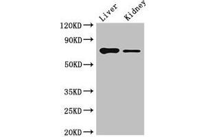 Western Blot Positive WB detected in: Mouse liver tissue, Mouse kidney tissue All lanes: DEF6 antibody at 4 μg/mL Secondary Goat polyclonal to rabbit IgG at 1/50000 dilution Predicted band size: 74 kDa Observed band size: 74 kDa (DEF6 anticorps  (AA 20-114))