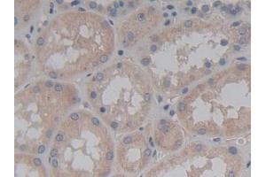 Detection of ABCC2 in Human Kidney Tissue using Polyclonal Antibody to ATP Binding Cassette Transporter C2 (ABCC2)
