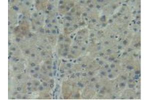 IHC-P analysis of Human Liver Tissue, with DAB staining. (ITGAD anticorps  (AA 879-1099))