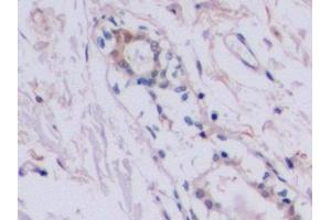 Detection of TIMP2 in Human Mammary gland Tissue using Polyclonal Antibody to Tissue Inhibitors Of Metalloproteinase 2 (TIMP2) (TIMP2 anticorps  (AA 27-220))