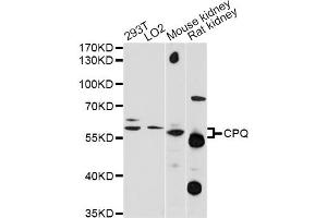 Western blot analysis of extracts of various cell lines, using CPQ antibody (ABIN6293987) at 1:1000 dilution.