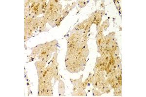 Immunohistochemistry of paraffin-embedded Human esophageal using MVP antibody at dilution of 1:100 (x400 lens). (MVP anticorps)
