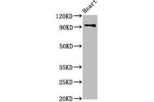Western Blot Positive WB detected in: Rat heart tissue All lanes: DLG2 antibody at 2. (DLG2 anticorps  (AA 310-420))