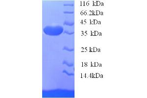 SDS-PAGE (SDS) image for Secreted phosphoprotein 1 (SPP1) (AA 17-290), (partial) protein (His tag) (ABIN5713862)