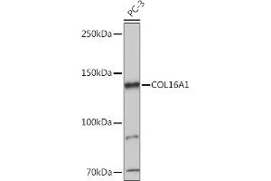 Western blot analysis of extracts of PC-3 cells, using COL16 antibody (8837) at 1:1000 dilution. (COL16A1 anticorps  (AA 1000-1100))