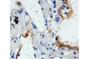 IHC-P analysis of lung tissue, with DAB staining. (SFTPB anticorps  (AA 201-381))