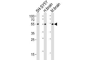 Western blot analysis of lysates from SH-SY5Y cell line, human brain, mouse brain tissue(from left to right), using CHRM2 Antibody (ABIN6242476 and ABIN6577085). (Muscarinic Acetylcholine Receptor M2 anticorps)