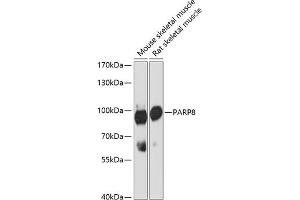 Western blot analysis of extracts of various cell lines, using P antibody (ABIN6133216, ABIN6145242, ABIN6145243 and ABIN6216694) at 1:3000 dilution. (PARP8 anticorps  (AA 1-300))