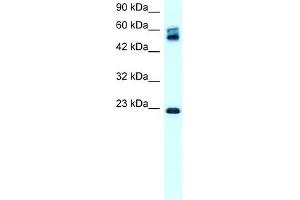WB Suggested Anti-CLDN8 Antibody Titration:  0. (CLDN8 anticorps  (C-Term))