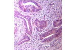 TLR5 Immunohistochemistry. (TLR5 anticorps)