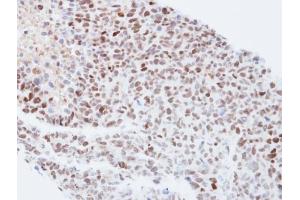 IHC-P Image Immunohistochemical analysis of paraffin-embedded H1299 xenograft, using KPNA4, antibody at 1:500 dilution. (KPNA4 anticorps  (C-Term))