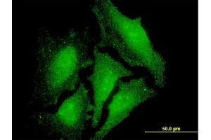 Immunofluorescence of monoclonal antibody to LMO3 on HeLa cell. (LMO3 anticorps  (AA 91-146))