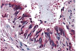 Human Lung, Respiratory Epithelium (formalin-fixed, paraffin-embedded) stained with CCR3 antibody ABIN364440 at 10 ug/ml followed by biotinylated anti-mouse IgG secondary antibody ABIN481714, alkaline phosphatase-streptavidin and chromogen. (CCR3 anticorps)