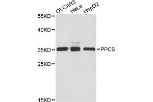 Western blot analysis of extracts of various cell lines, using PPCS antibody (ABIN6293765) at 1:3000 dilution.