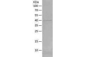 Western Blotting (WB) image for DNA Meiotic Recombinase 1 (DMC1) (AA 1-176) protein (His-IF2DI Tag) (ABIN7122683)